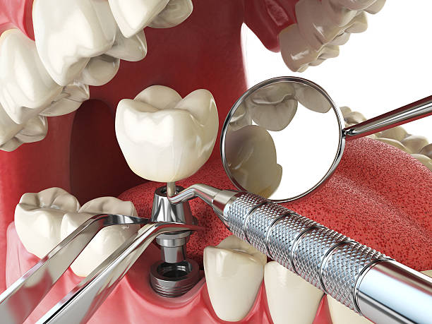 Best Mobile Emergency Dentist in Cave Springs, AR