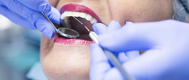 Best Emergency Dentist for Lost Fillings or Crowns in Cave Springs, AR